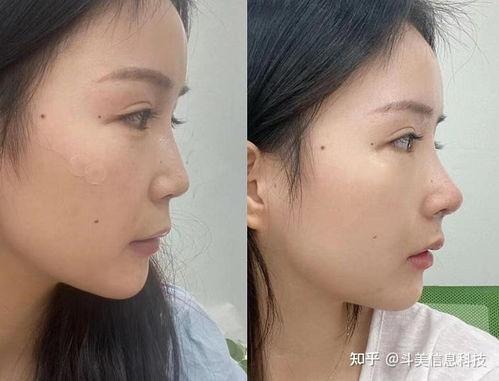 杭州整容爆料案件最新情况,真相逐步浮出水面 第2张 杭州整容爆料案件最新情况,真相逐步浮出水面 第2张